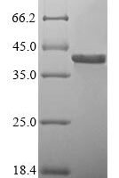 Recombinant Human Platelet glycoprotein Ib beta chain (GP1BB) Protein - BioCrest Sci