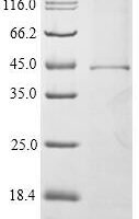 Recombinant Mouse High affinity immunoglobulin epsilon receptor subunit alpha (Fcer1a) Protein - BioCrest Sci
