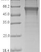 Recombinant Human Protein cereblon (CRBN) Protein - BioCrest Sci