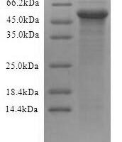 Recombinant Human Protein cereblon (CRBN) Protein - BioCrest Sci