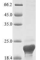 Recombinant Human Retroviral-like aspartic protease 1 (ASPRV1) Protein - BioCrest Sci