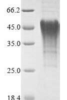 Recombinant Mouse BCL2/adenovirus E1B 19 kDa protein-interacting protein 3 (Bnip3), partial Protein - BioCrest Sci