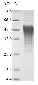 Recombinant Mouse BCL2/adenovirus E1B 19 kDa protein-interacting protein 3 (Bnip3), partial Protein, Mus musculus (Mouse), in vitro E.coli expression system, N-terminal 6xHis-tagged, 21.3kDa, purity >90% as determined by SDS-PAGE.