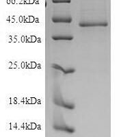 Recombinant Human Endothelin B receptor (EDNRB) Protein - BioCrest Sci