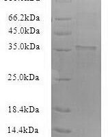 Recombinant Bacillus subtilis Biofilm-surface layer protein A (bslA) Protein - BioCrest Sci