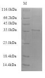 (Tris-Glycine gel) Discontinuous SDS-PAGE (reduced) with 5% enrichment gel and 15% separation gel.