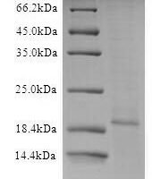 Recombinant Influenza A virus Matrix protein 2 (M) Protein - BioCrest Sci