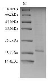 Recombinant Influenza A virus Matrix protein 2 (M) Protein, Influenza A virus (strain A/USA:Phila/1935 H1N1), in vitro E.coli expression system, N-terminal 6xHis-tagged, 15.1kDa, purity >90% as determined by SDS-PAGE.