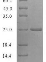 Recombinant Vaccinia virus Protein I5 (VACWR074) Protein - BioCrest Sci