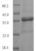 Recombinant Human Transmembrane protein 65 (TMEM65), partial Protein - BioCrest Sci