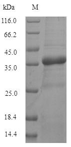 Recombinant Human Transmembrane protein 65 (TMEM65), partial Protein, Homo sapiens(Human), in vitro E.coli expression system, N-terminal 6xHis-SUMO-tagged, 35.1kDa, purity >90% as determined by SDS-PAGE.