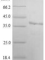 Recombinant Human E3 ubiquitin-protein ligase MARCH2 (MARCH2) Protein - BioCrest Sci