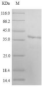 Recombinant Human E3 ubiquitin-protein ligase MARCH2 (MARCH2) Protein, Homo sapiens (Human), in vitro E.coli expression system, N-terminal 6xHis-SUMO-tagged, 43.0kDa, purity >90% as determined by SDS-PAGE.