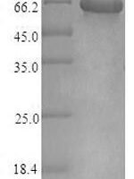 Recombinant Human ATP-sensitive inward rectifier potassium channel 10 (KCNJ10) Protein - BioCrest Sci