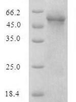 Recombinant Yersinia enterocolitica Protein YopB (yopB) Protein - BioCrest Sci