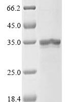 Recombinant Human Diacylglycerol O-acyltransferase 1 (DGAT1) Protein - BioCrest Sci