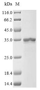 Recombinant Human Diacylglycerol O-acyltransferase 1 (DGAT1) Protein, Homo sapiens (Human), in vitro E.coli expression system, N-terminal 10xHis-tagged and C-terminal Myc-tagged, 37.1kDa, purity >85% as determined by SDS-PAGE.