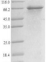 Recombinant Human Sterol regulatory element-binding protein 1 (SREBF1), partial Protein - BioCrest Sci