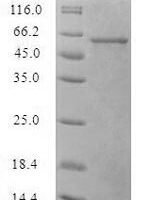 Recombinant Orientia tsutsugamushi 56 kDa type-specific antigen Protein - BioCrest Sci