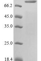 Recombinant Varicella-zoster virus Envelope glycoprotein E (gE) Protein - BioCrest Sci