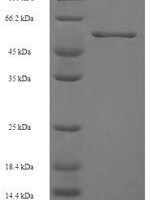 Recombinant Human C-X-C chemokine receptor type 4 (CXCR4) Protein - BioCrest Sci