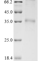 Recombinant Mouse C-C chemokine receptor type 8 (Ccr8) Protein - BioCrest Sci