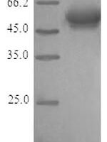 Recombinant Human Atypical chemokine receptor 3 (ACKR3) Protein - BioCrest Sci