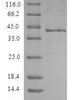 Recombinant Human C-X-C chemokine receptor type 3 (CXCR3) Protein - BioCrest Sci
