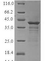 Recombinant Human C-C chemokine receptor type 6 (CCR6) Protein - BioCrest Sci