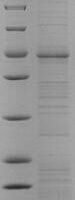 Recombinant Human Endothelin-1 receptor (EDNRA) Protein - BioCrest Sci