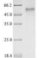 Recombinant Human 5-hydroxytryptamine receptor 7 (HTR7) Protein - BioCrest Sci