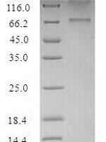 Recombinant Human 5-hydroxytryptamine receptor 2B (HTR2B) Protein - BioCrest Sci