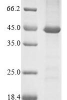 Recombinant Human Tumor necrosis factor receptor superfamily member 6 (FAS) Protein - BioCrest Sci