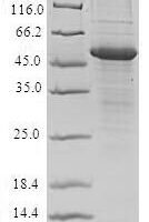 Recombinant Human Poliovirus receptor (PVR) Protein - BioCrest Sci
