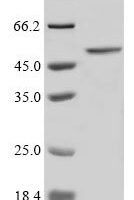 Recombinant Human Beta-galactoside alpha-2,6-sialyltransferase 1 (ST6GAL1) Protein - BioCrest Sci