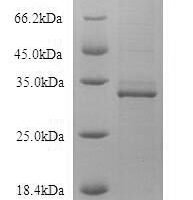 Recombinant Human B-lymphocyte antigen CD19 (CD19), partial Protein - BioCrest Sci