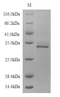 Recombinant Human B-lymphocyte antigen CD19 (CD19), partial Protein, Homo sapiens(Human), in vitro E.coli expression system, N-terminal 6xHis-tagged, 34.1kDa, purity >90% as determined by SDS-PAGE.