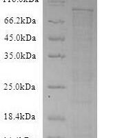 Recombinant Mouse Dipeptidyl peptidase 4 (Dpp4), partial Protein - BioCrest Sci