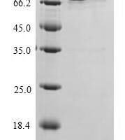Recombinant Escherichia coli Probable phosphatidylethanolamine transferase Mcr-1 (mcr1) Protein - BioCrest Sci