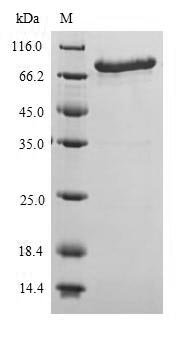 Recombinant Escherichia coli Probable phosphatidylethanolamine transferase Mcr-1 (mcr1) Protein, Escherichia coli, in vitro E.coli expression system, N-terminal 6xHis-SUMO-tagged, 76.1kDa, purity >90% as determined by SDS-PAGE.