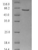 Recombinant Human Beta-2 adrenergic receptor (ADRB2) (G16R,E27Q) Protein - BioCrest Sci