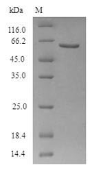 Recombinant Human Beta-2 adrenergic receptor (ADRB2) (G16R,E27Q) Protein, Homo sapiens (Human), in vitro E.coli expression system, N-terminal 6xHis-SUMO-tagged, 62.5kDa, purity >90% as determined by SDS-PAGE.