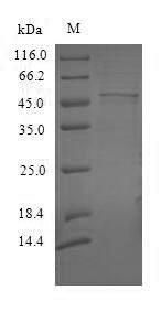 (Tris-Glycine gel) Discontinuous SDS-PAGE (reduced) with 5% enrichment gel and 15% separation gel.