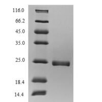 Recombinant Salmo salar Vertebrate ancient opsin, partial Protein - BioCrest Sci