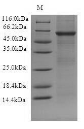 Recombinant Human Toll-like receptor 10 (TLR10), partial Protein, Homo sapiens(Human), in vitro E.coli expression system, N-terminal 10xHis-tagged, 68.1kDa, purity >90% as determined by SDS-PAGE.
