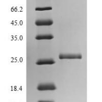 Recombinant Human cytomegalovirus Uncharacterized protein UL131 (UL131) Protein - BioCrest Sci
