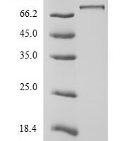 Recombinant Human Nucleolar transcription factor 1 (UBTF) Protein - BioCrest Sci