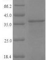 Recombinant Vaccinia virus Protein OPG190 (OPG190), partial Protein - BioCrest Sci