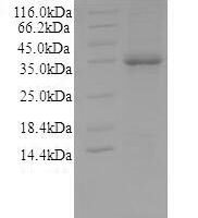 Recombinant Mouse Acid ceramidase (Asah1), partial Protein - BioCrest Sci