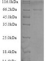Recombinant Human Neurofilament light polypeptide (NEFL) Protein - BioCrest Sci